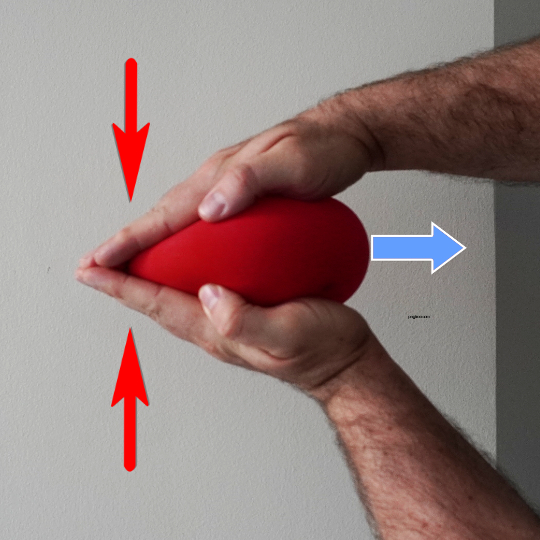 A red balloon between two hands, force is increased at the front to compress the front of the disc, the contents are now force out towards the back to create a "bulge"