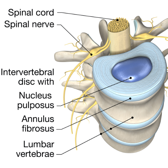 Diagram of basic lumbar spine anatomy showing disc structure, the spinal cord and nerve roots.