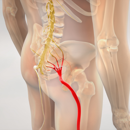3D render of the right side sciatic nerve