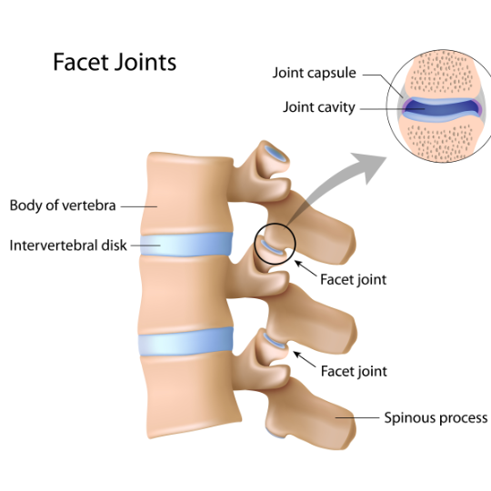 Diagram of the lumbar spine showing the facet joints