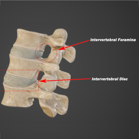 3 dimensional render of healthy lumbar vertebra with the foramina arrowed.